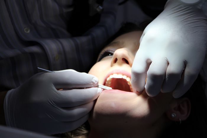 Benefits Root Canal