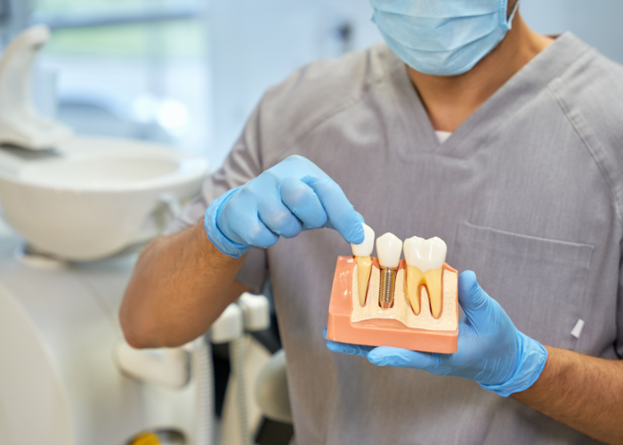 dental implants Moses Lake